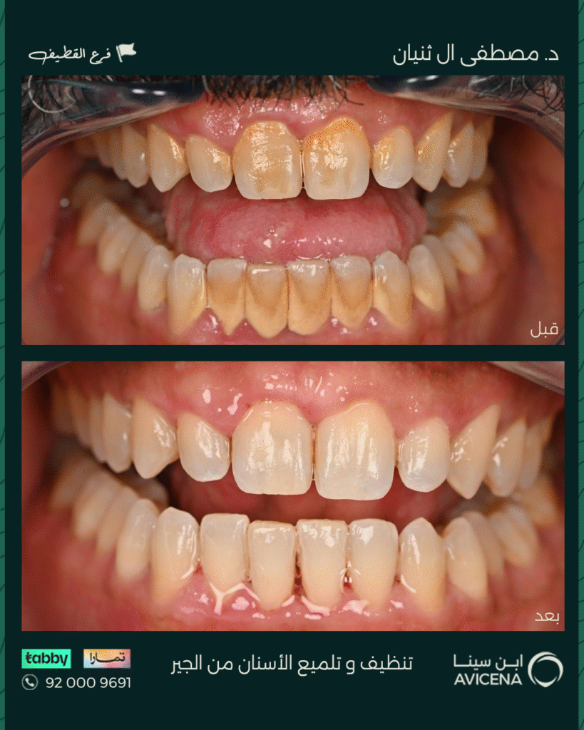 د. مصطفى آل ثنيان - قبل وبعد