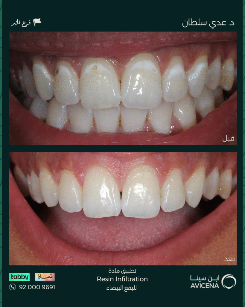 د. عدى السلطان - قبل وبعد