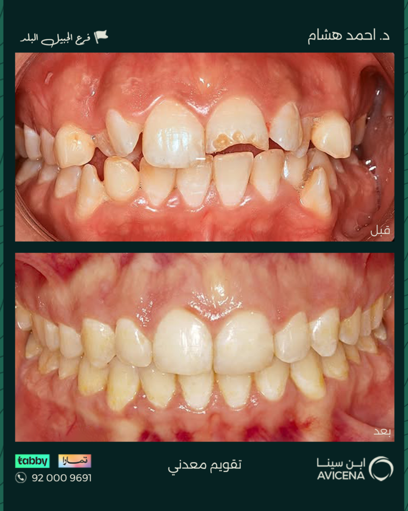 د. أحمد هشام عبد الهادي - قبل وبعد