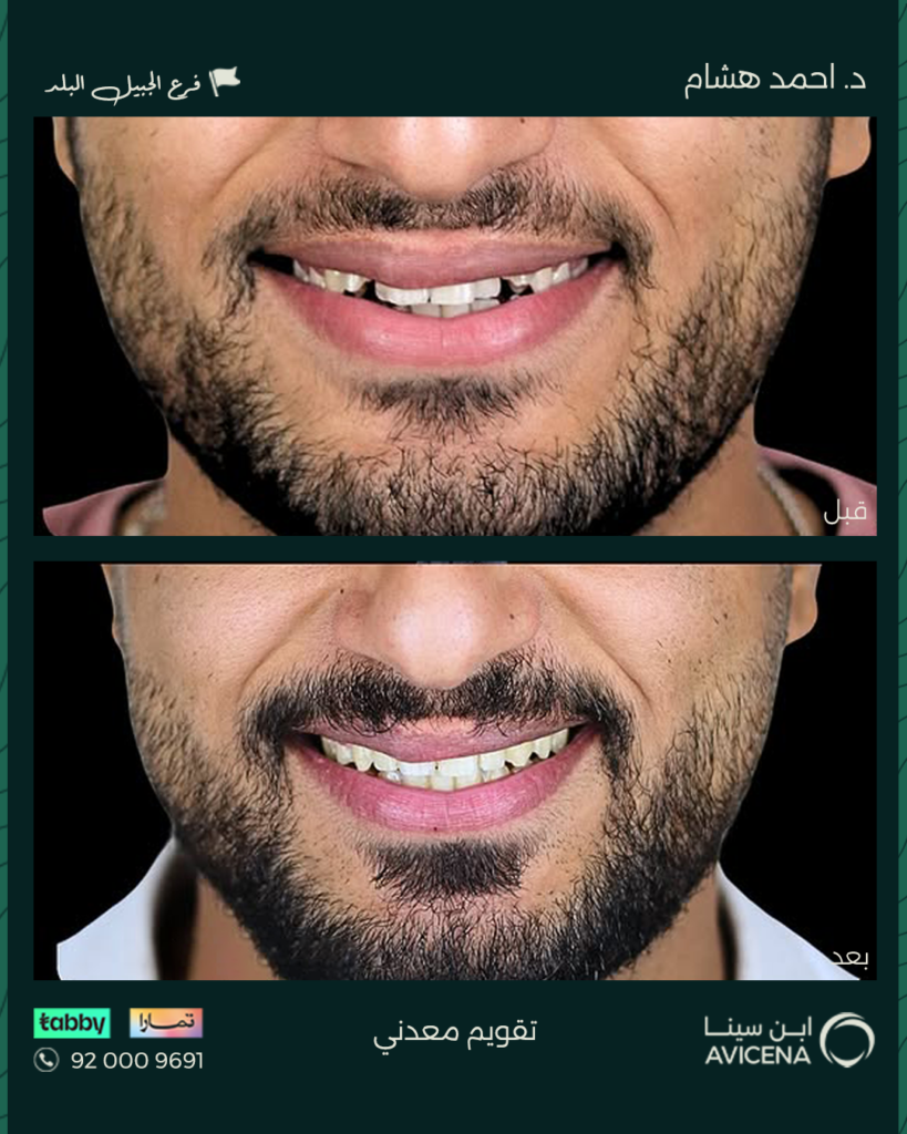Dr Ahmed Hisham Abdulhadi - Before After