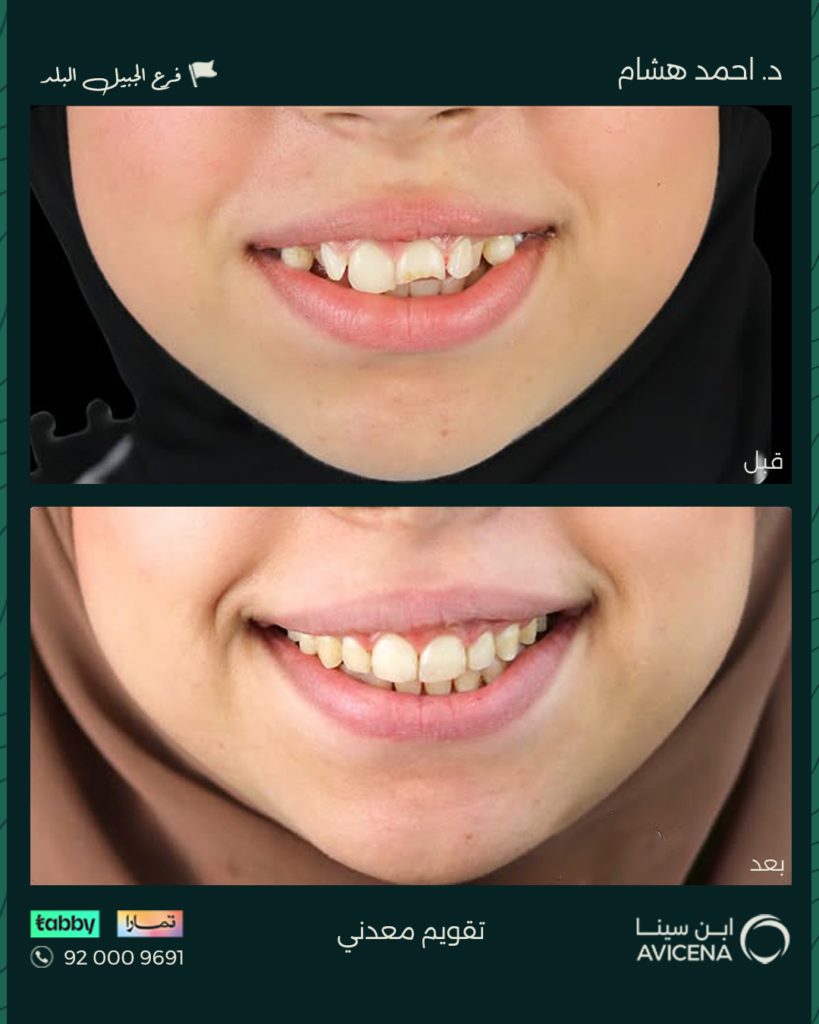 Dr Ahmed Hisham Abdulhadi - Before After