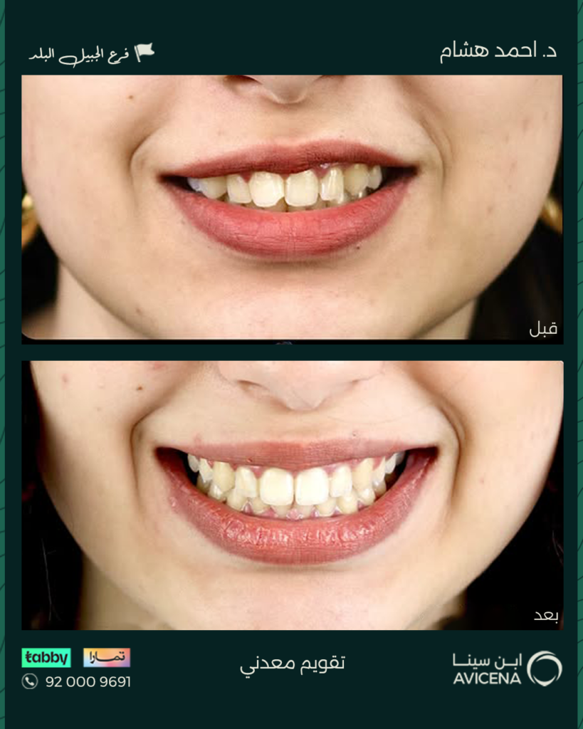 د. أحمد هشام عبد الهادي - قبل وبعد