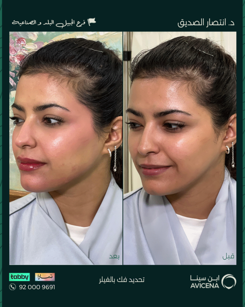 د. انتصار الصديق - قبل وبعد