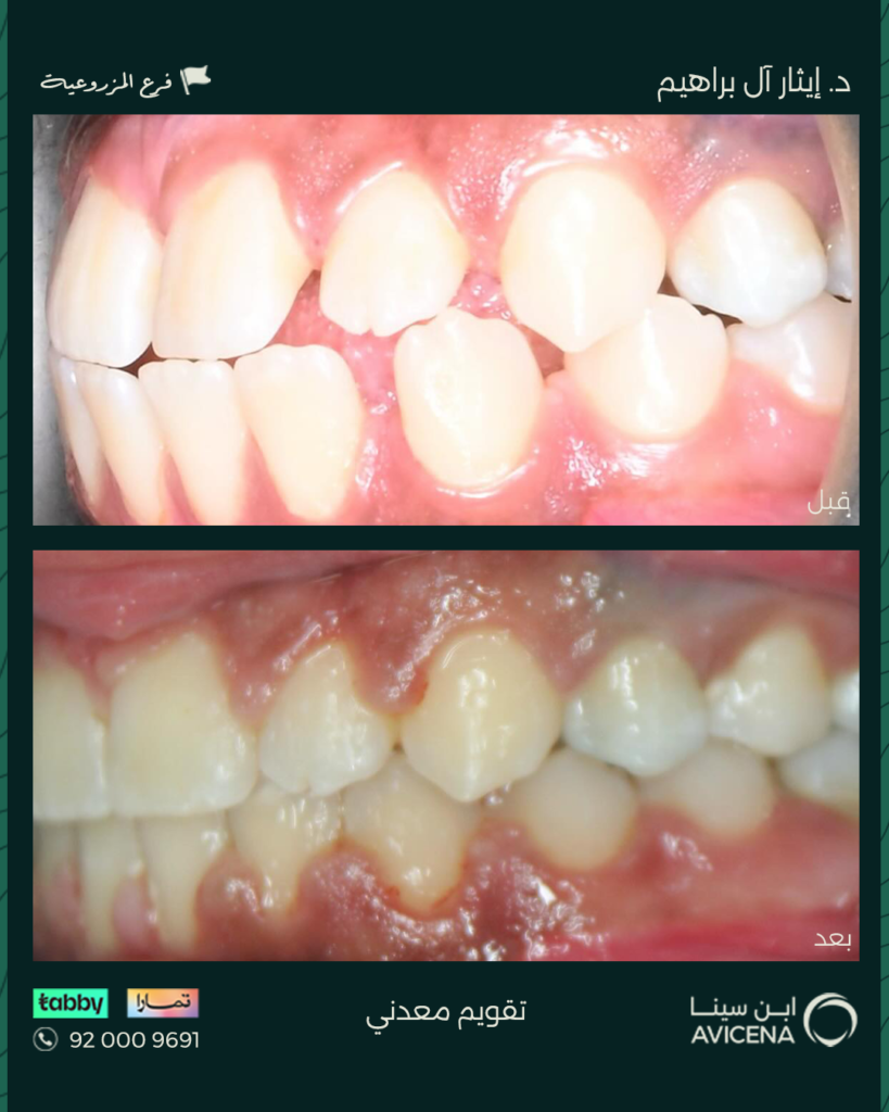 Dr. Ethar Basheer Al Ibrahim - Before After