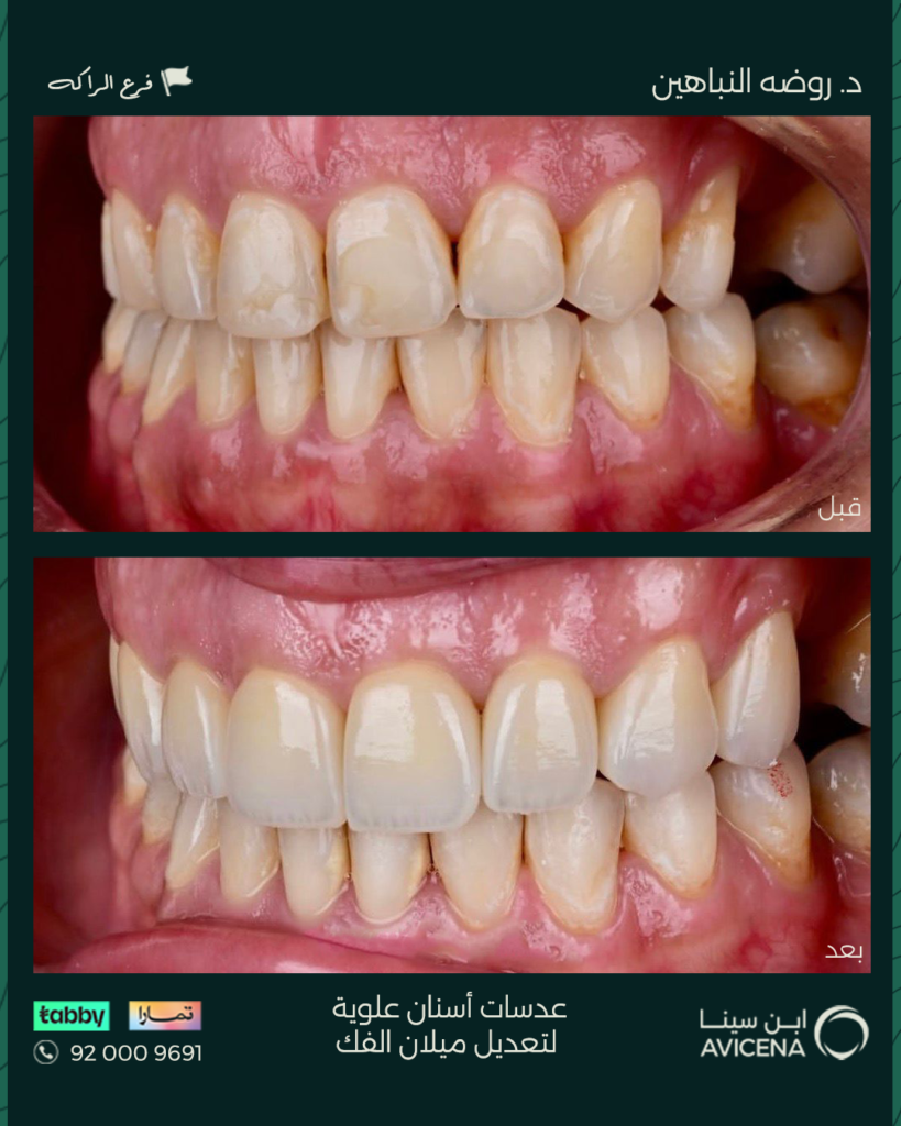 د. روضة النباهين - قبل وبعد