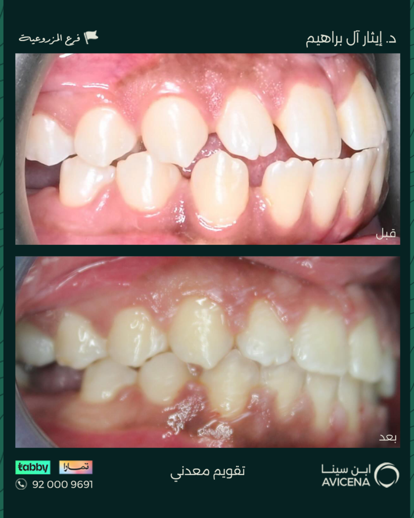 Dr. Ethar Basheer Al Ibrahim - Before After