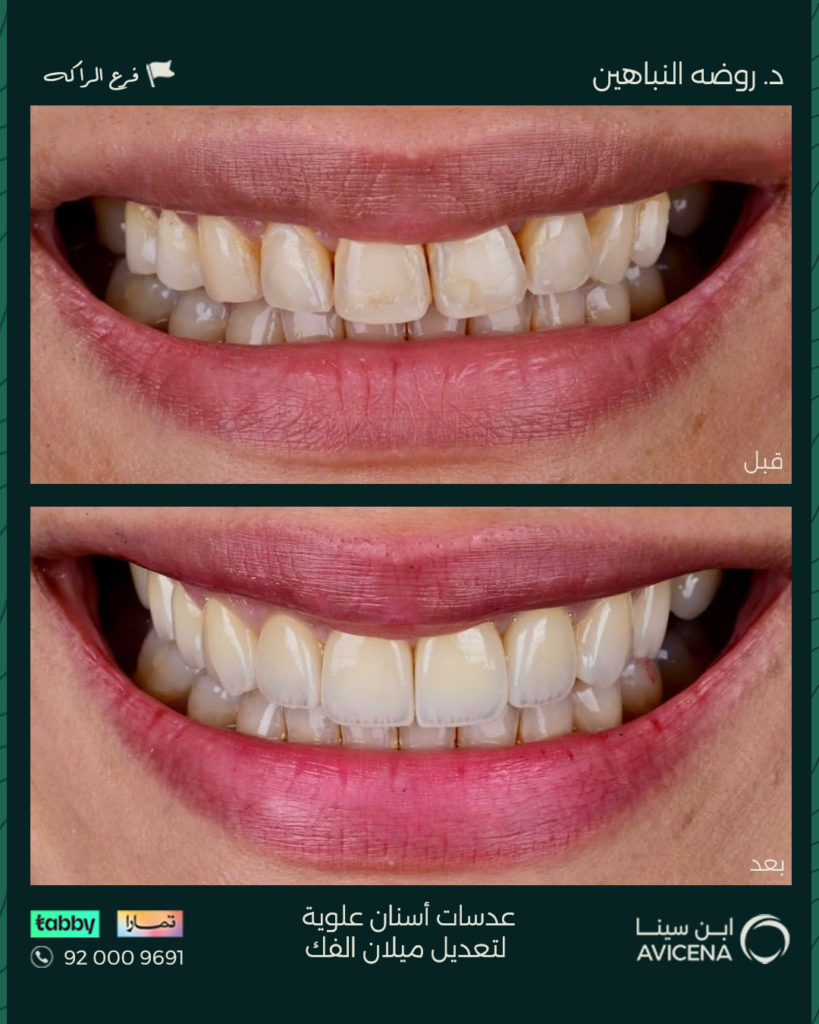 د. روضة النباهين - قبل وبعد