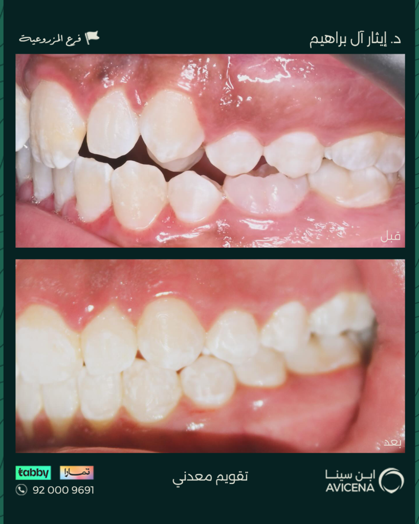 Dr. Ethar Basheer Al Ibrahim - Before After