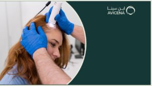 افضل علاج لتساقط الشعر وكيفية الوقاية منه