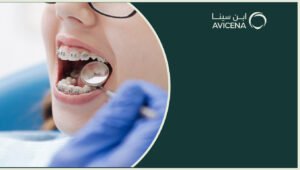 افضل عيادة لتقويم الاسنان وش أهم المعايير اللي لازم تدقق فيها؟