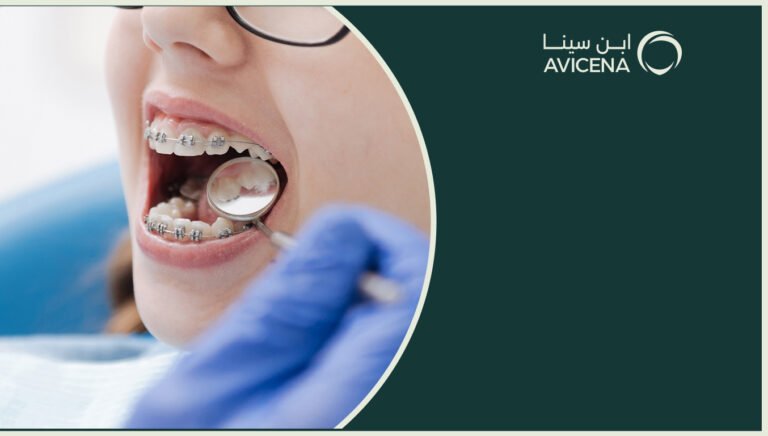 افضل عيادة لتقويم الاسنان وش أهم المعايير اللي لازم تدقق فيها؟