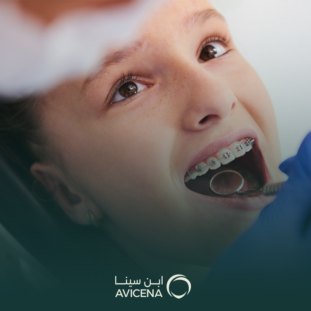 افضل عيادة لتقويم الاسنان