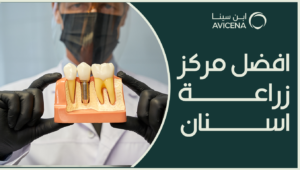 افضل مركز زراعة اسنان في 2025