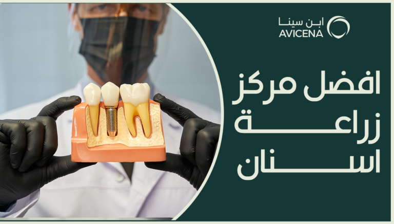 افضل مركز زراعة اسنان في 2025