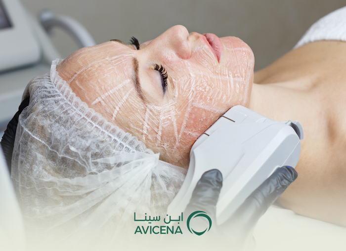 Facelift Surgery