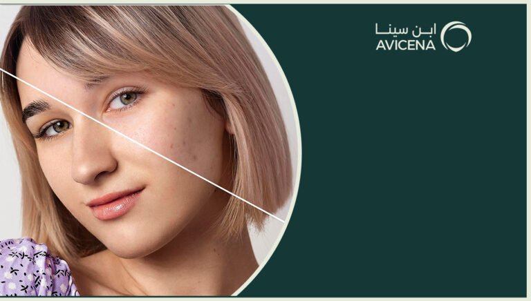 ما هو أفضل علاج اثار الندبات في الوجه؟