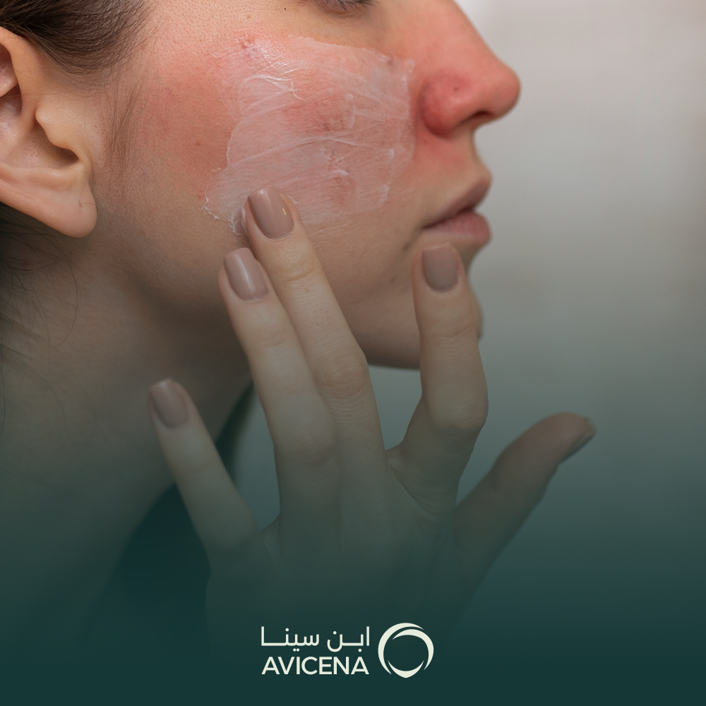 علاج آثار الندبات في الوجه
