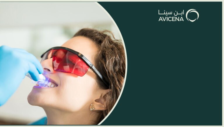 افضل مركز تبييض الاسنان في الراكة لعام 2025