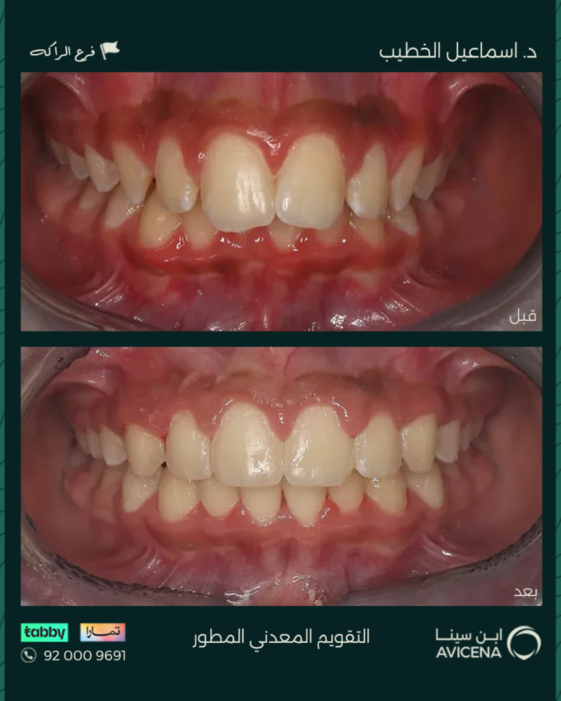 Dr. Ismail Al-Khatib - Before After