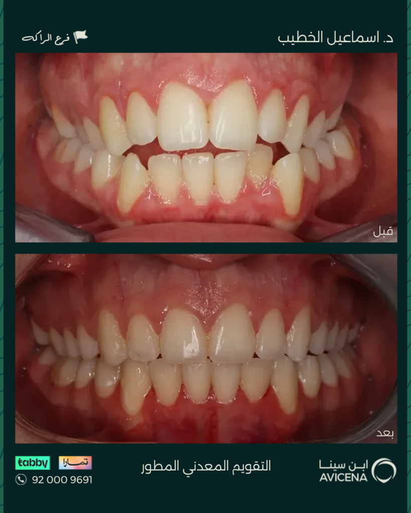 Dr. Ismail Al-Khatib - Before After