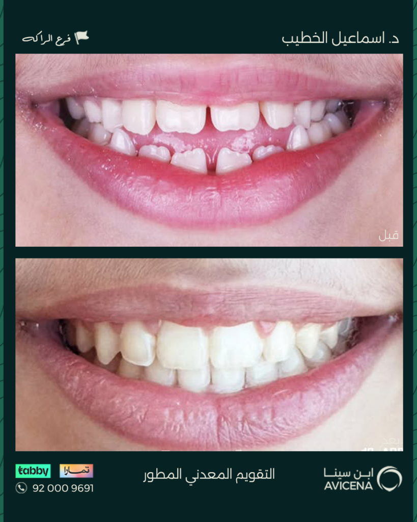 Dr. Ismail Al-Khatib - Before After