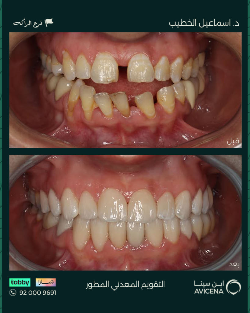 Dr. Ismail Al-Khatib - Before After