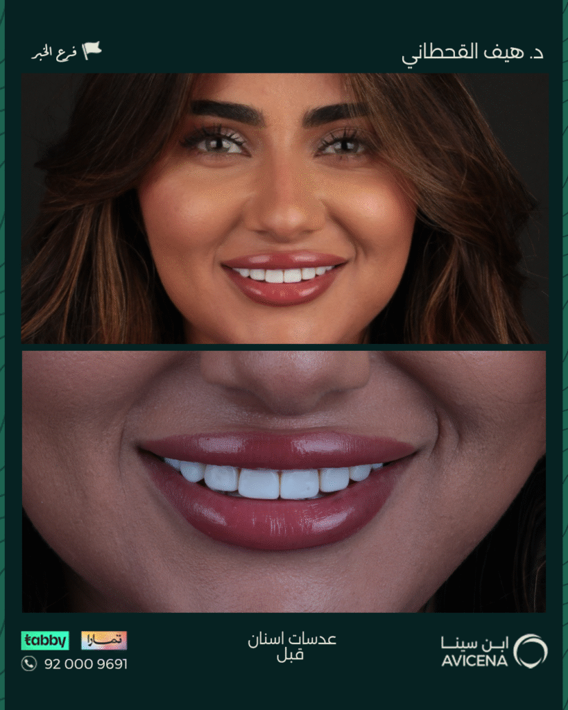 Dr. Haif Al-Qahtani - Before After