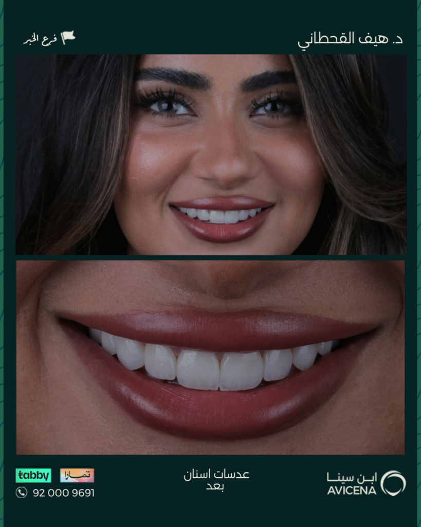 Dr. Haif Al-Qahtani - Before After