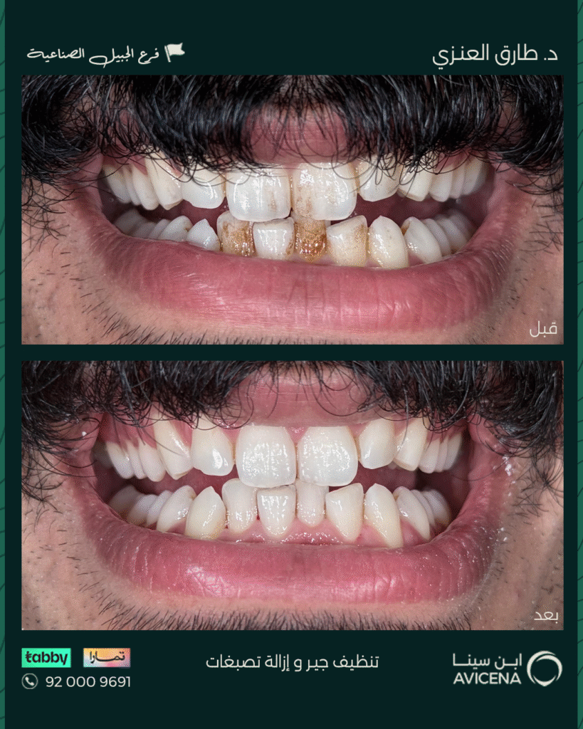 Dr. Tariq Al-Anzi - Before After