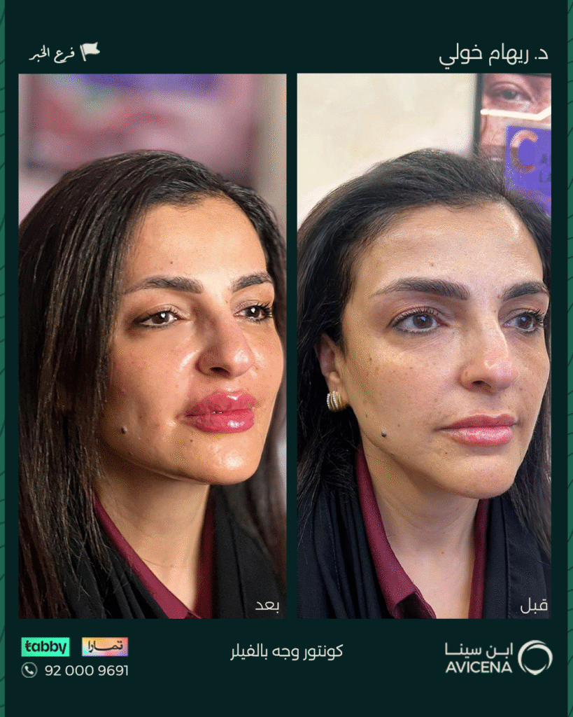 Dr. Reham El-Kholi - Before After