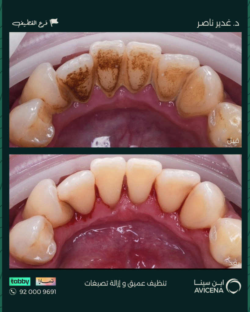 Dr. Ghadeer Nasser - Before After