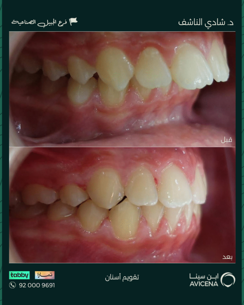 Dr. Shadi Al-Nashef - Before After