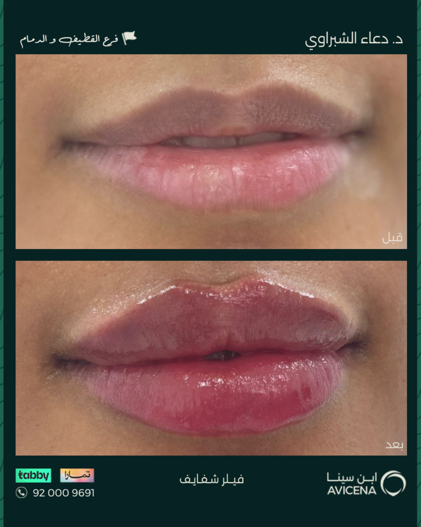 Dr. Duaa Al-Shabrawy - Before After