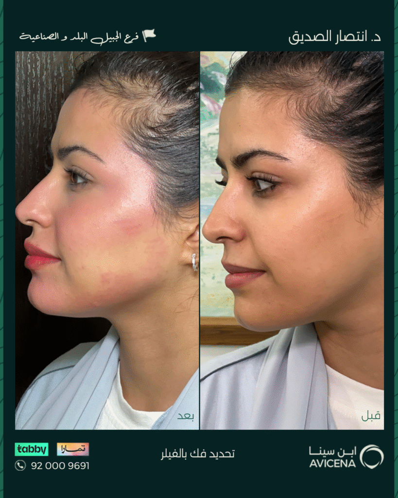 Dr. Intisar Al-Siddiq - Before After