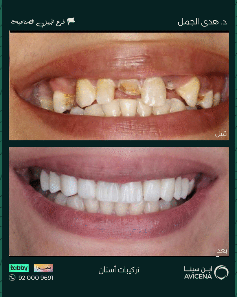 Dr. Huda Al-Jamal - Before After