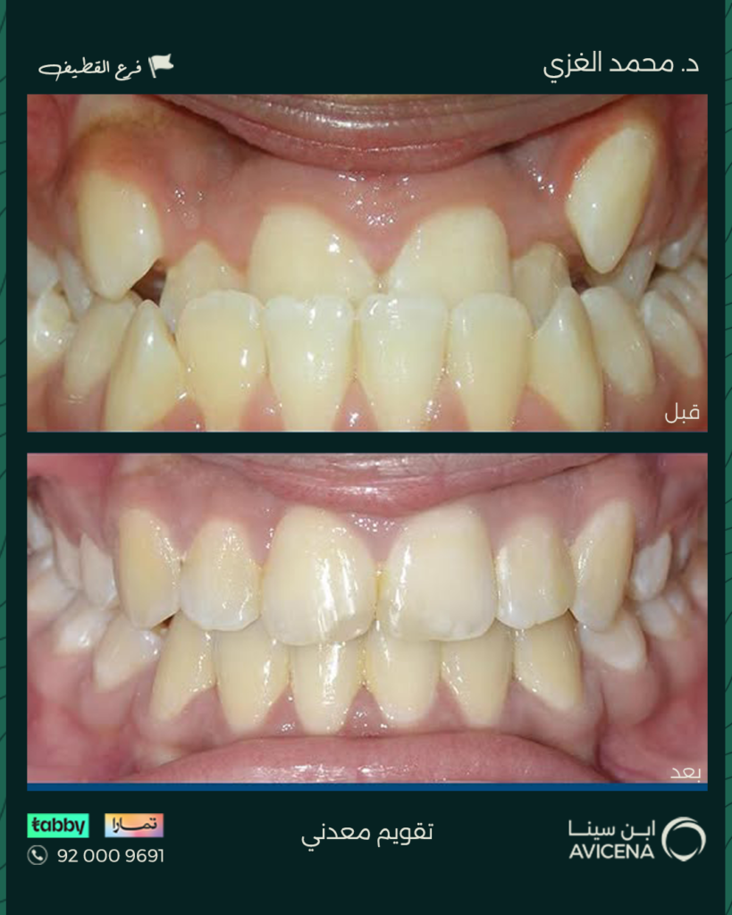Dr. Mohammed Al-Ghazi - Before After