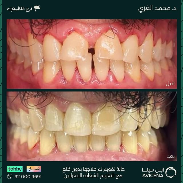 Dr. Mohammed Al-Ghazi - Before After