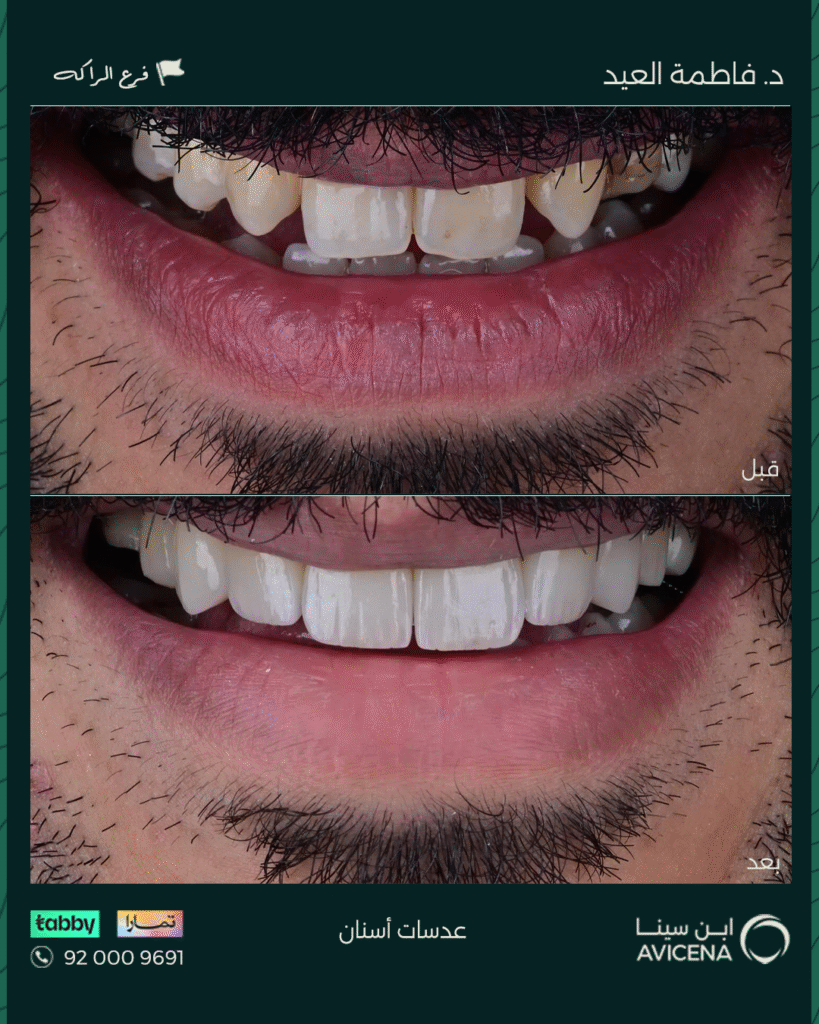 Dr. Fatima Al Eid - Before After