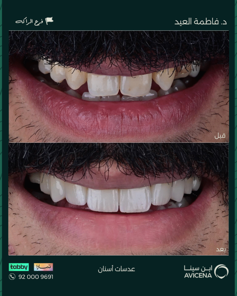 Dr. Fatima Al Eid - Before After