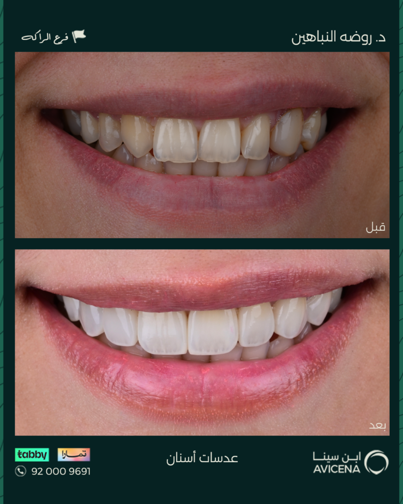 Dr. Rawda Al-Nabahin - Before After