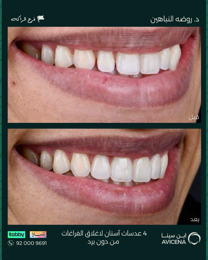 Dr. Rawda Al-Nabahin - Before After