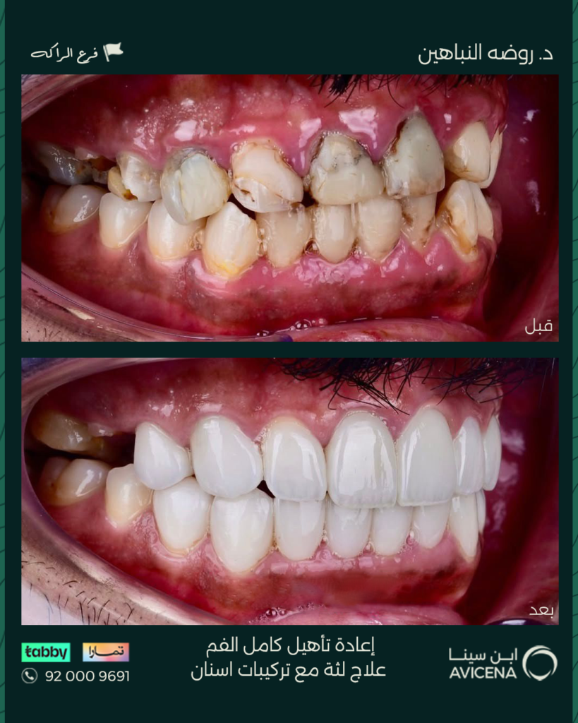Dr. Rawda Al-Nabahin - Before After
