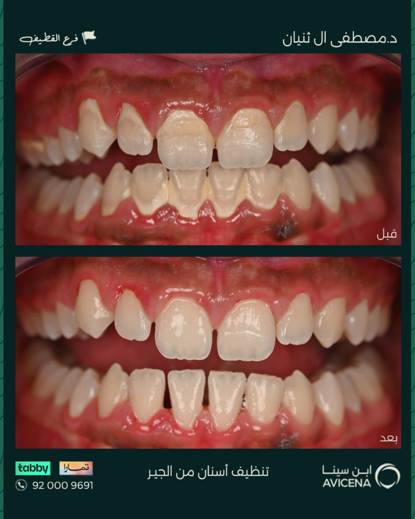 Dr. Mustafa Al-Thunayan - Before After