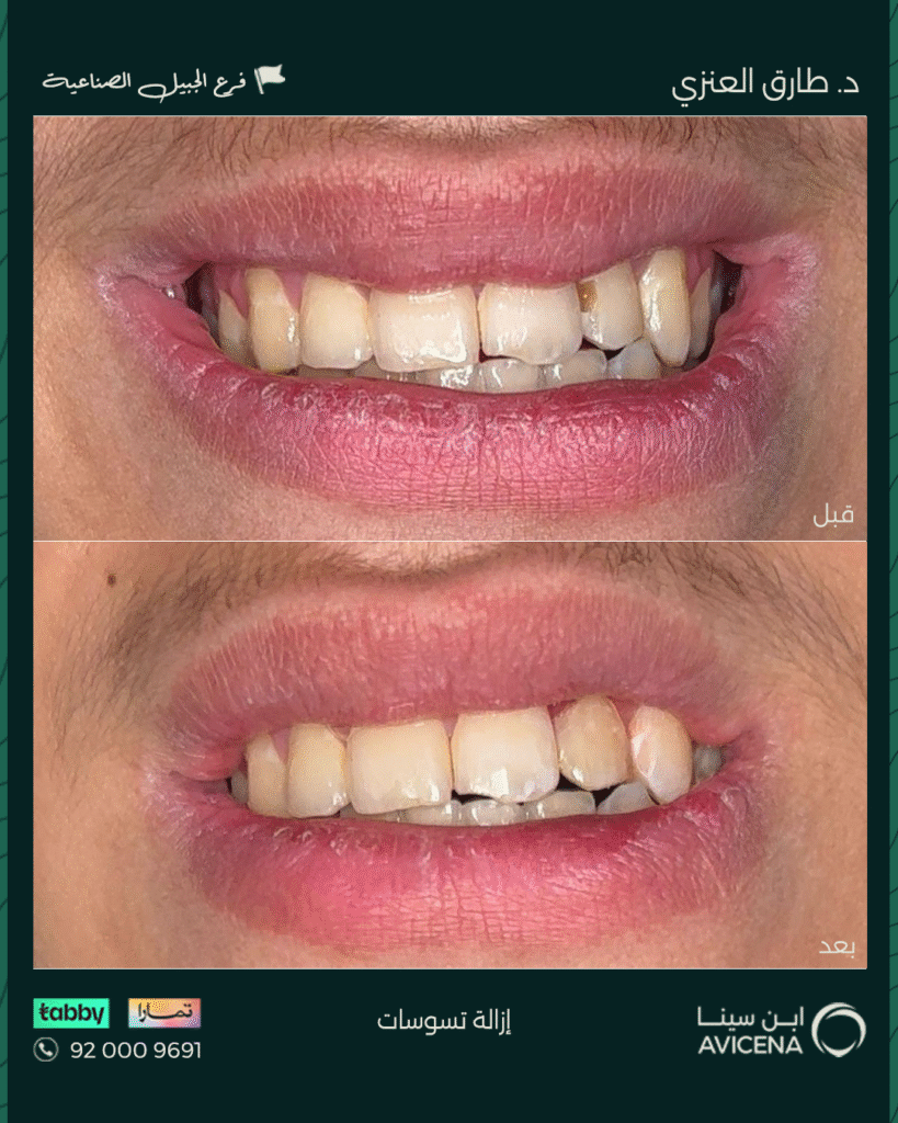 Dr. Tariq Al-Anzi - Before After