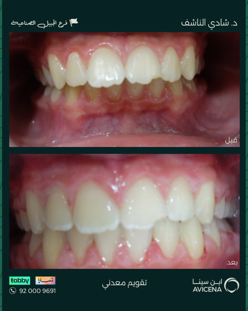 Dr. Shadi Al-Nashef - Before After
