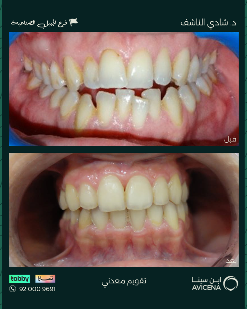 Dr. Shadi Al-Nashef - Before After