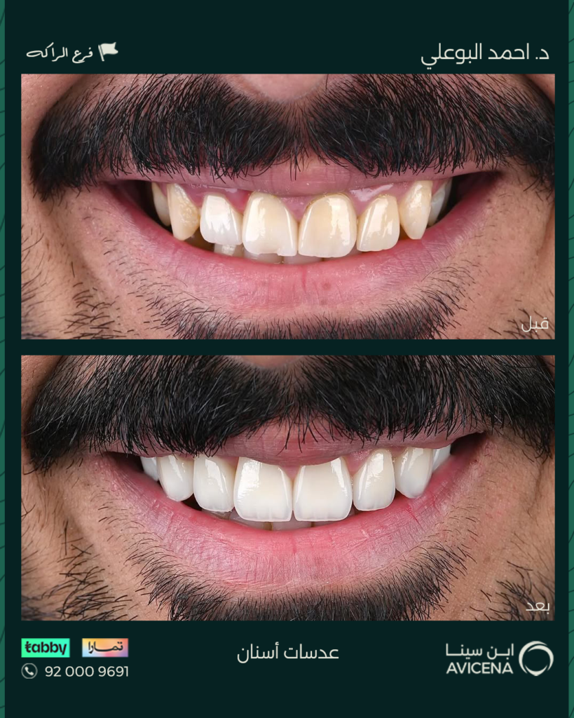 Dr. Ahmed Al-Bouali - Before After