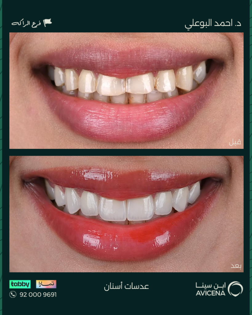 Dr. Ahmed Al-Bouali - Before After