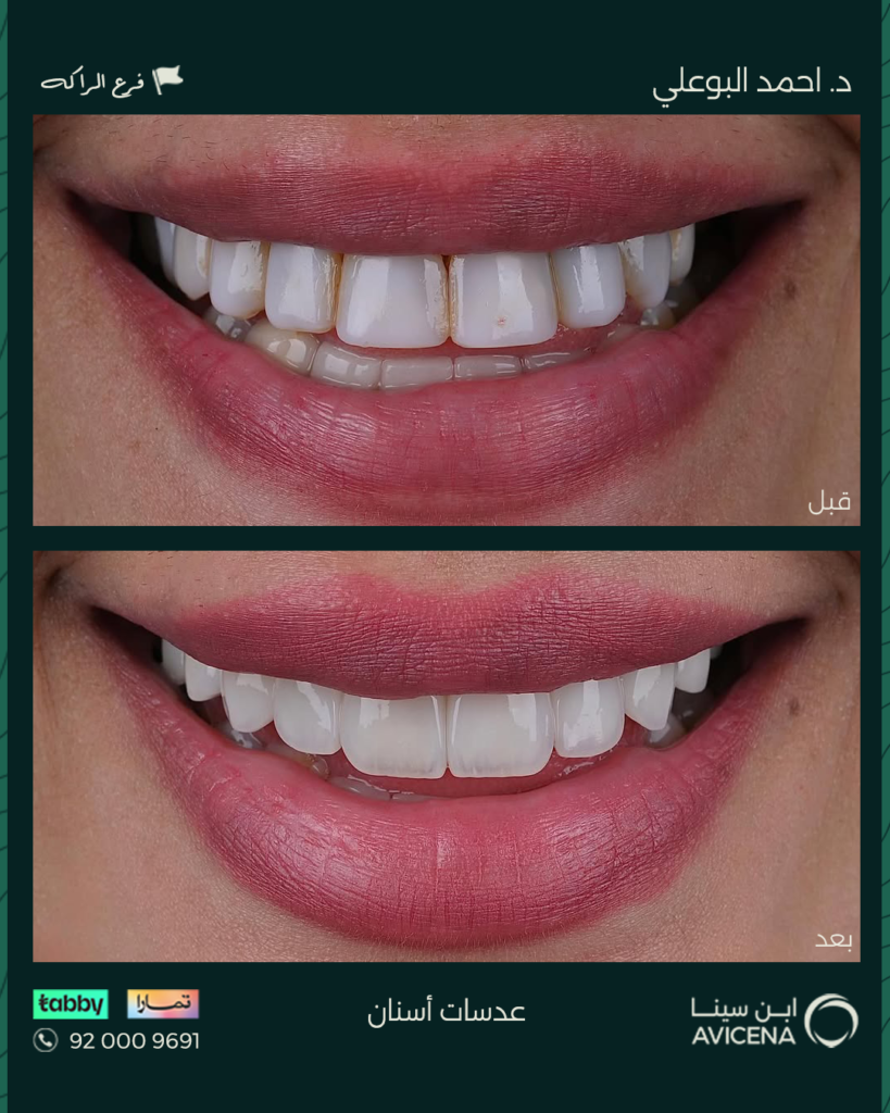 Dr. Ahmed Al-Bouali - Before After