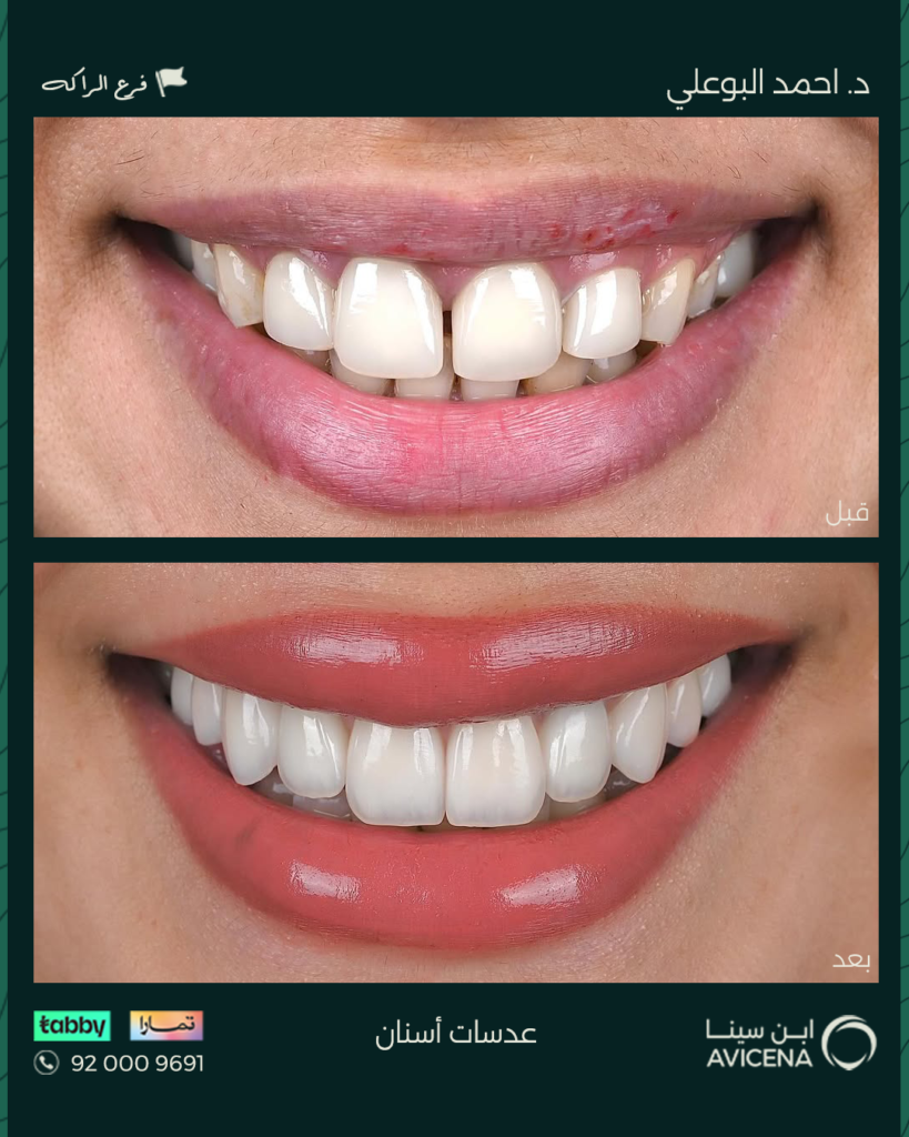 Dr. Ahmed Al-Bouali - Before After